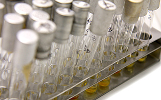 Pierwszy przypadek odry wśród Polaków. Na Warmii i Mazurach chorowali dotychczas pracownicy z Ukrainy Pierwszy przypadek odry wśród Polaków. Na Warmii i Mazurach chorowali dotychczas pracownicy z Ukrainy